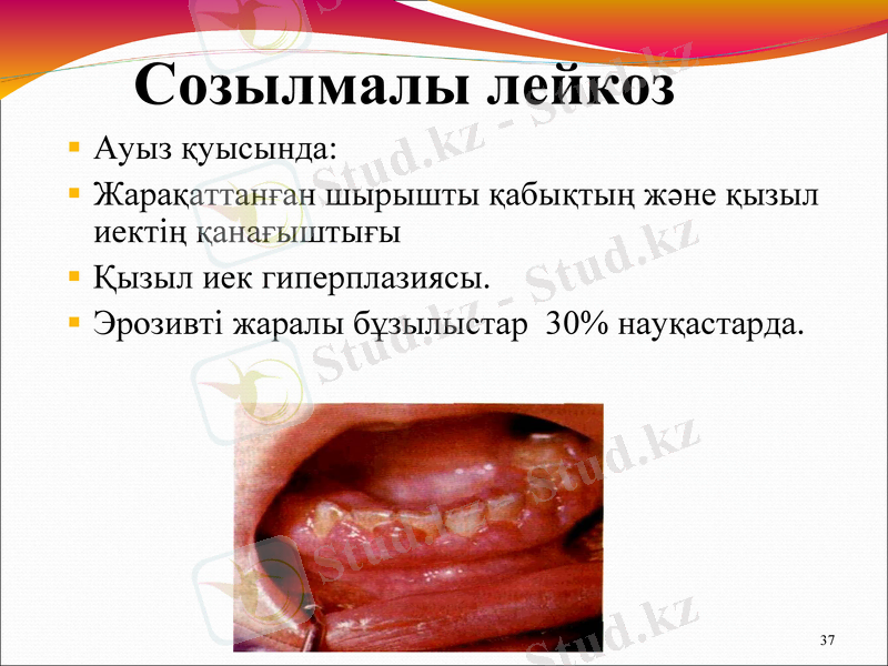 Slide 37