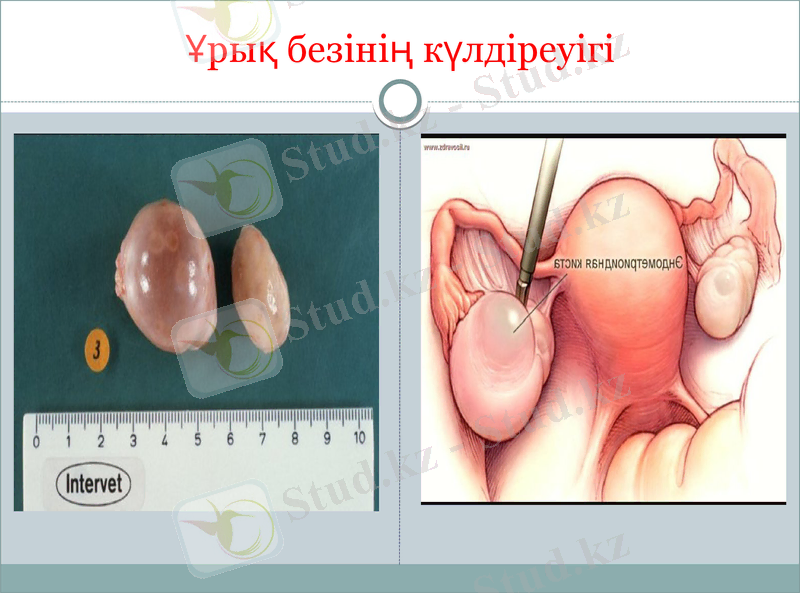 Slide 14