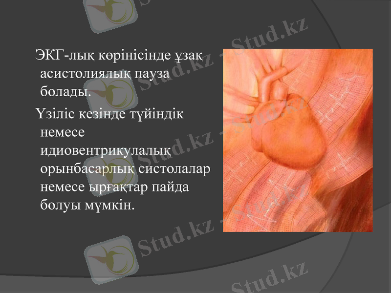 Slide 25