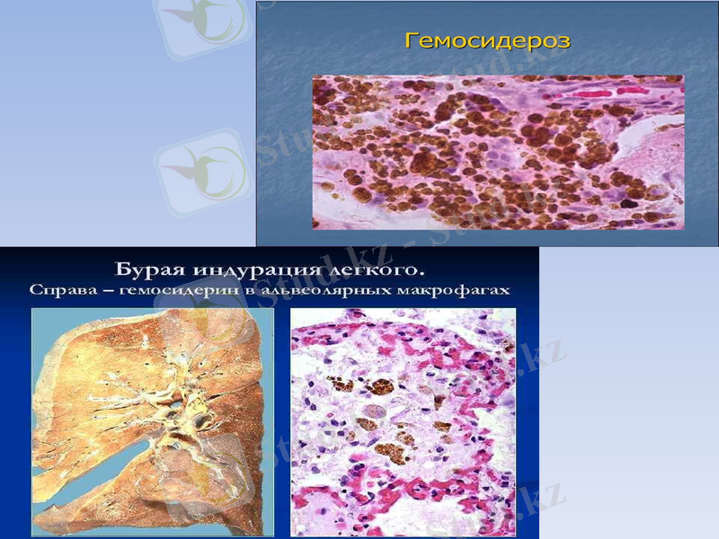 Slide 17
