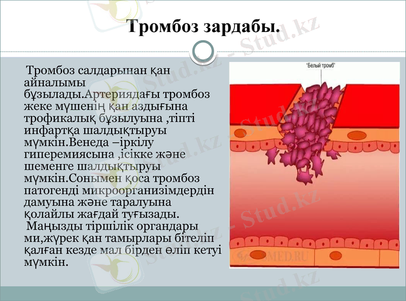 Slide 13