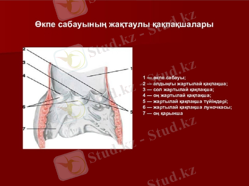 Slide 14