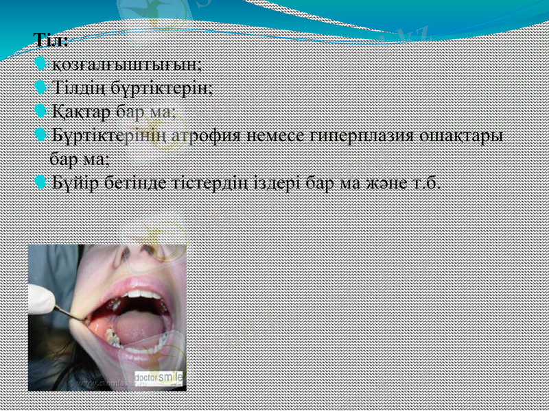 Slide 14