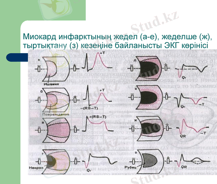 Slide 14