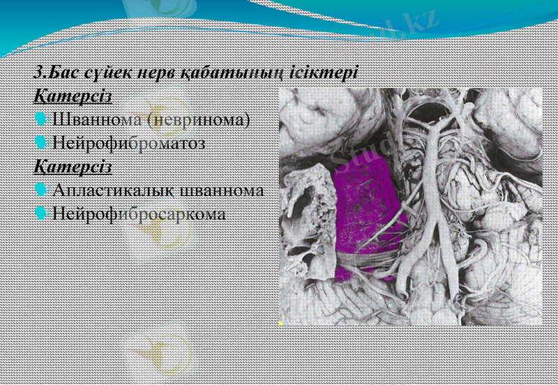Slide 11