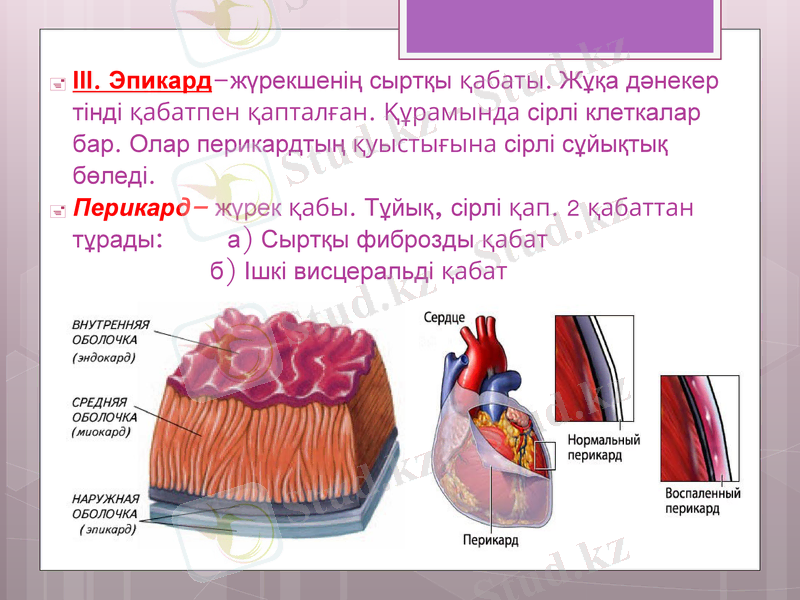 Slide 14