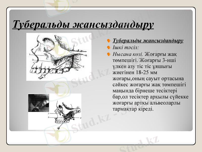 Slide 13