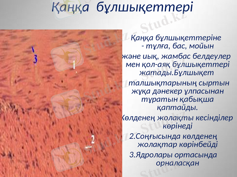 Slide 26